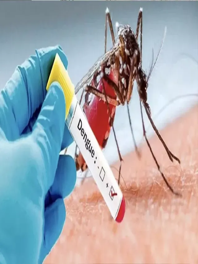 patna-dengue-outbreak-over-18-new-cases-recorded-in-24-hours-health-dept-intensifies-measures