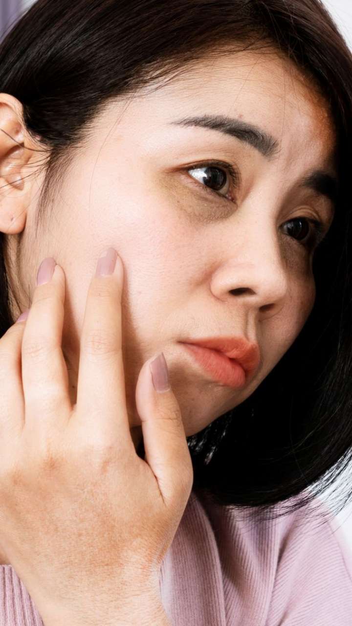 Follow This One Habit Every Night To Reduce Dark Circles