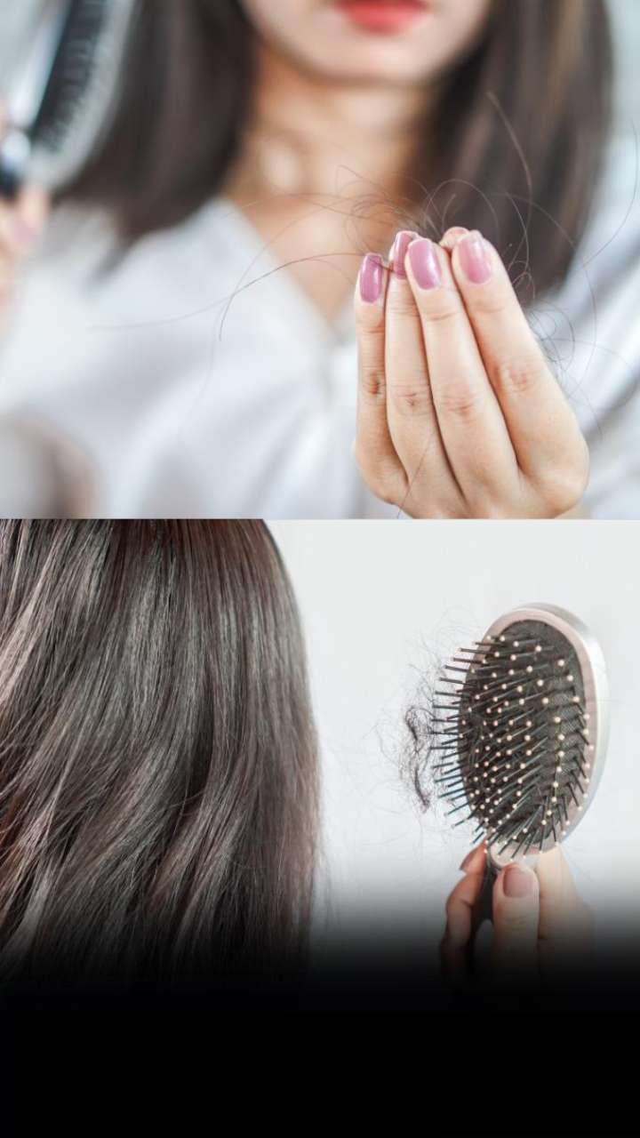 Best Natural Home Remedies To Stop Hair Fall You Must Know