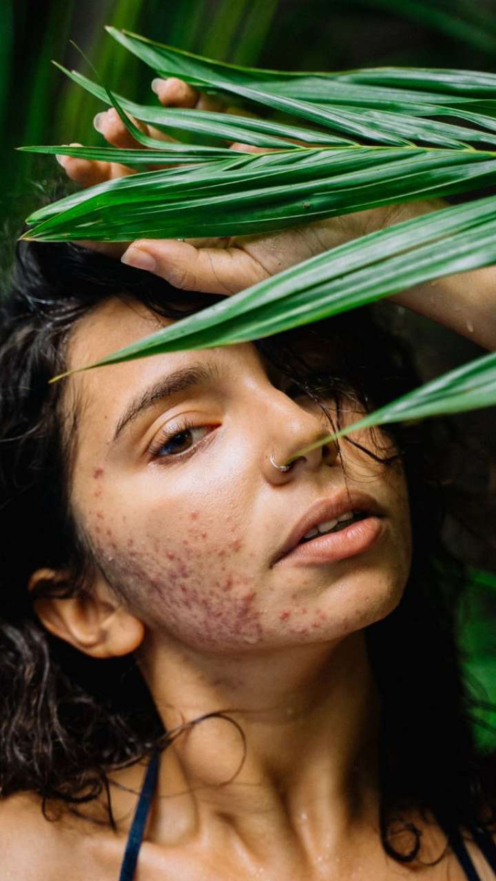 5 Tulsi Face Masks For Acne Prone And Sensitive Skin