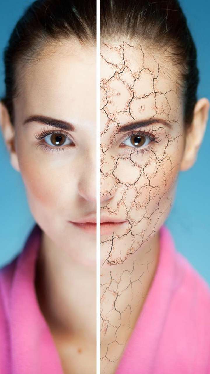 Update more than 155 besan for hair best tnbvietnam.edu.vn