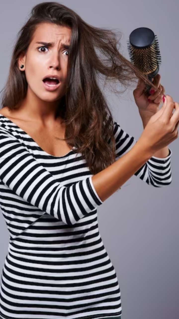 Top 6 Tips To Control Hair Fall In Winter 7753